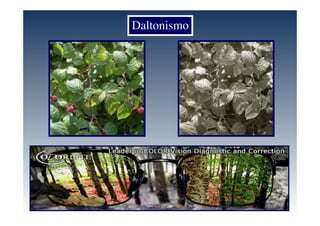 Daltonismo
 