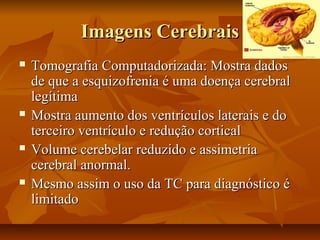 Imagens CerebraisImagens Cerebrais
 Tomografia Computadorizada: Mostra dadosTomografia Computadorizada: Mostra dados
de que a esquizofrenia é uma doença cerebralde que a esquizofrenia é uma doença cerebral
legítimalegítima
 Mostra aumento dos ventrículos laterais e doMostra aumento dos ventrículos laterais e do
terceiro ventrículo e redução corticalterceiro ventrículo e redução cortical
 Volume cerebelar reduzido e assimetriaVolume cerebelar reduzido e assimetria
cerebral anormal.cerebral anormal.
 Mesmo assim o uso da TC para diagnóstico éMesmo assim o uso da TC para diagnóstico é
limitadolimitado
 