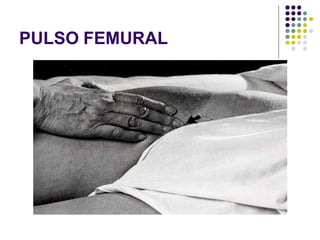 PULSO FEMURAL
 