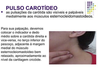 PULSO CAROTÍDEO 
 as pulsações da carótida são visíveis e palpáveis 
medialmente aos músculos esternocleidomastoideos. 
Para sua palpação, devemos 
colocar o indicador e dedo 
médio sobre a carótida direita e 
vice-versa, no terço inferior do 
pescoço, adjacente à margem 
medial do músculo 
esternocleiomastoideo bem 
relaxado, aproximadamente ao 
nível da cartilagem cricóide. 
 