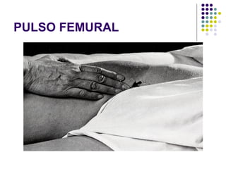 PULSO FEMURAL 
 