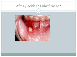 Aftas / acidez? Lubrificação?
 