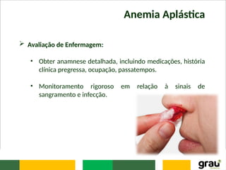 Anemia Aplástica
 Avaliação de Enfermagem:
• Obter anamnese detalhada, incluindo medicações, história
clínica pregressa, ocupação, passatempos.
• Monitoramento rigoroso em relação à sinais de
sangramento e infecção.
 