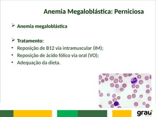 Anemia Megaloblástica: Perniciosa
 Anemia megaloblástica
 Tratamento:
• Reposição de B12 via intramuscular (IM);
• Reposição de ácido fólico via oral (VO);
• Adequação da dieta.
 