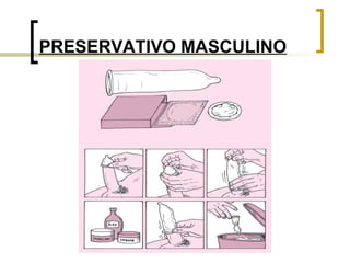PRESERVATIVO MASCULINO 
 