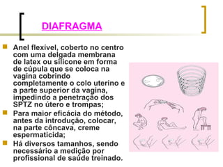 DIAFRAGMA 
 Anel flexível, coberto no centro 
com uma delgada membrana 
de latex ou silicone em forma 
de cúpula que se coloca na 
vagina cobrindo 
completamente o colo uterino e 
a parte superior da vagina, 
impedindo a penetração dos 
SPTZ no útero e trompas; 
 Para maior eficácia do método, 
antes da introdução, colocar, 
na parte côncava, creme 
espermaticida; 
 Há diversos tamanhos, sendo 
necessário a medição por 
profissional de saúde treinado. 
 
