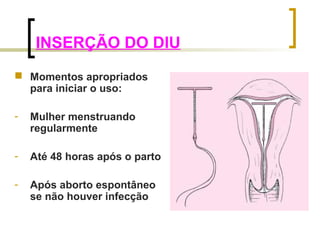 INSERÇÃO DO DIU 
 Momentos apropriados 
para iniciar o uso: 
- Mulher menstruando 
regularmente 
- Até 48 horas após o parto 
- Após aborto espontâneo 
se não houver infecção 
 