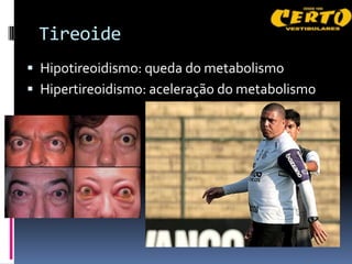 Tireoide
 Hipotireoidismo: queda do metabolismo
 Hipertireoidismo: aceleração do metabolismo
 