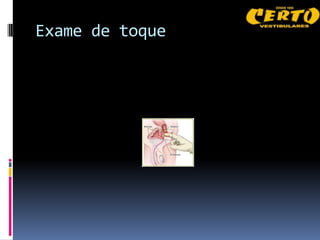 Exame de toque
 