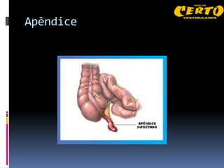Apêndice
 