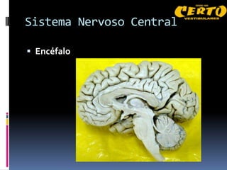 Sistema Nervoso Central

 Encéfalo
 