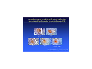 A rosiglitazona, ao contrário das SU ou da metformina
aumenta as ilhas de insulina em camundongos db/db




             db/db                RSG




     GLIB             MET                    controle magro


                            Lister CA, et al. 1999. Diabetologia 42 (Supplement 1):A150.
 