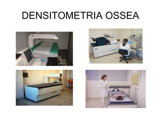 DENSITOMETRIA OSSEA
 