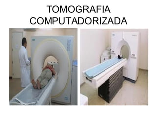 TOMOGRAFIA
COMPUTADORIZADA
 
