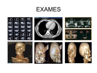 EXAMES
 