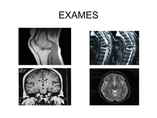 EXAMES
 