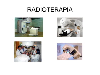 RADIOTERAPIA
 