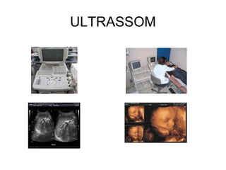 ULTRASSOM
 