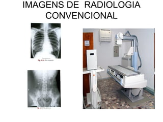 IMAGENS DE RADIOLOGIA
    CONVENCIONAL
 