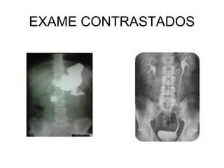 EXAME CONTRASTADOS
 