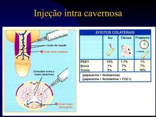 Aula para segundo ano FMUSP - fisiologia e disfunção erétil | PPT