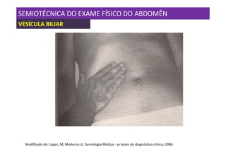 SEMIOTÉCNICA DO EXAME FÍSICO DO ABDOMÊN
VESÍCULA BILIAR




  Modificado de: López, M; Medeiros JL. Semiologia Médica - as bases do diagnóstico clínico; 1986.
 