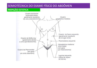 SEMIOTÉCNICA DO EXAME FÍSICO DO ABDÔMEN
INSPEÇÃO ESTÁTICA
 