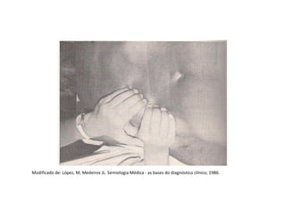 Modificado de: López, M; Medeiros JL. Semiologia Médica - as bases do diagnóstico clínico; 1986.
 