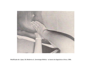 Modificado de: López, M; Medeiros JL. Semiologia Médica - as bases do diagnóstico clínico; 1986.
 