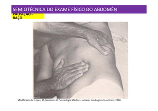 SEMIOTÉCNICA DO EXAME FÍSICO DO ABDOMÊN
PALPAÇÃO -
BAÇO




  Modificado de: López, M; Medeiros JL. Semiologia Médica - as bases do diagnóstico clínico; 1986.
 
