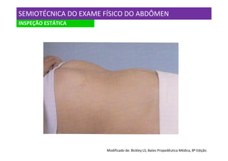 SEMIOTÉCNICA DO EXAME FÍSICO DO ABDÔMEN
INSPEÇÃO ESTÁTICA




                      Modificado de: Bickley LS, Bates Propedêutica Médica, 8º Edição
 