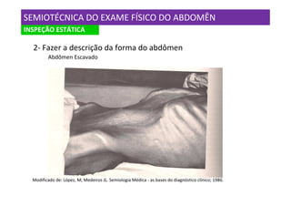 SEMIOTÉCNICA DO EXAME FÍSICO DO ABDOMÊN
INSPEÇÃO ESTÁTICA

  2- Fazer a descrição da forma do abdômen
         Abdômen Escavado




  Modificado de: López, M; Medeiros JL. Semiologia Médica - as bases do diagnóstico clínico; 1986.
 
