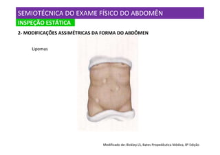 SEMIOTÉCNICA DO EXAME FÍSICO DO ABDOMÊN
INSPEÇÃO ESTÁTICA
2- MODIFICAÇÕES ASSIMÉTRICAS DA FORMA DO ABDÔMEN


     Lipomas




                               Modificado de: Bickley LS, Bates Propedêutica Médica, 8º Edição
 