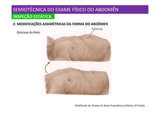 SEMIOTÉCNICA DO EXAME FÍSICO DO ABDOMÊN
INSPEÇÃO ESTÁTICA
2- MODIFICAÇÕES ASSIMÉTRICAS DA FORMA DO ABDÔMEN

 Diástase do Reto




                               Modificado de: Bickley LS, Bates Propedêutica Médica, 8º Edição
 