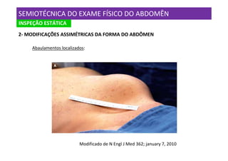 SEMIOTÉCNICA DO EXAME FÍSICO DO ABDOMÊN
INSPEÇÃO ESTÁTICA
2- MODIFICAÇÕES ASSIMÉTRICAS DA FORMA DO ABDÔMEN

    Abaulamentos localizados:




                          Modificado de N Engl J Med 362; january 7, 2010
 