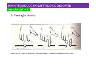 SEMIOTÉCNICA DO EXAME FÍSICO DO ABDOMÊN
INSPEÇÃO ESTÁTICA

  3- Circulação Venosa




  Modificado de: López, M; Medeiros JL. Semiologia Médica - as bases do diagnóstico clínico; 1986.
 