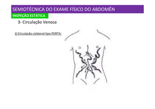 SEMIOTÉCNICA DO EXAME FÍSICO DO ABDOMÊN
INSPEÇÃO ESTÁTICA
   3- Circulação Venosa

 1) Circulação colateral tipo PORTA:
 