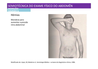 SEMIOTÉCNICA DO EXAME FÍSICO DO ABDOMÊN
INSPEÇÃO
DINÂMICA
  Hérnias
  Manobras para
  aumentar a pressão
  intra-abdominal




  Modificado de: López, M; Medeiros JL. Semiologia Médica - as bases do diagnóstico clínico; 1986.
 