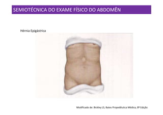 SEMIOTÉCNICA DO EXAME FÍSICO DO ABDOMÊN


  Hérnia Epigástrica




                       Modificado de: Bickley LS, Bates Propedêutica Médica, 8º Edição
 