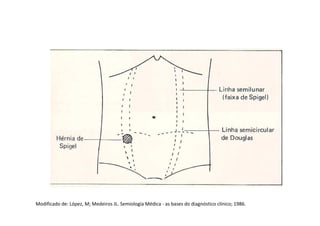 Modificado de: López, M; Medeiros JL. Semiologia Médica - as bases do diagnóstico clínico; 1986.
 
