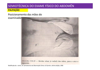 SEMIOTÉCNICA DO EXAME FÍSICO DO ABDOMÊN
PALPAÇÃO
Posicionamento das mãos do
examinador




Modificado de: Júnior, JR. Semiotécnica da Observação Clínica. Ed Sarvier, sétima edição, 1986
 