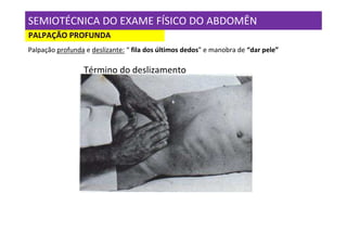 SEMIOTÉCNICA DO EXAME FÍSICO DO ABDOMÊN
PALPAÇÃO PROFUNDA
Palpação profunda e deslizante: “ fila dos últimos dedos” e manobra de “dar pele”

                  Término do deslizamento
 