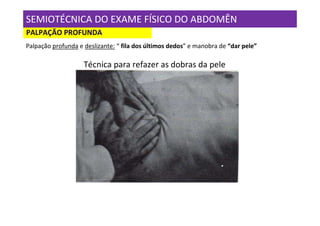 SEMIOTÉCNICA DO EXAME FÍSICO DO ABDOMÊN
PALPAÇÃO PROFUNDA
Palpação profunda e deslizante: “ fila dos últimos dedos” e manobra de “dar pele”

                    Técnica para refazer as dobras da pele
 