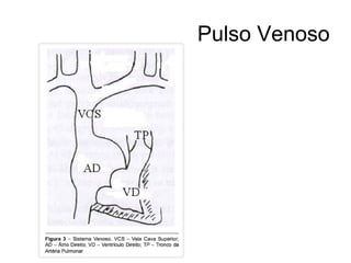 Pulso Venoso
 