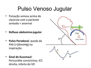 Pulso Venoso Jugular
• Pulsação venosa acima da
clavícula com o paciente
sentado = anormal
• Refluxo abdomino-jugular
• Pulso Paradoxal: queda da
PAS (>10mmHg) na
inspiração.
• Sinal de Kussmaul:
Pericardite constrictiva, ICC
direita, infarto do VD
 