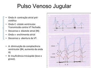 Pulso Venoso Jugular
– Onda A- contração atrial pré-
sistólica
– Onda C- sístole ventricular.
Transmissão contra VT fechada.
– Descenso x- diástole atrial (RI)
– Onda v- enchimento atrial
– Descenso y- abertura da VT.
– A: diminuição da complacência
ventricular (B4, aumento da onda
A)
– B: Insuficiência tricúspide (leve e
grave).
A
B
 