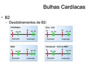 Bulhas CardíacasBulhas Cardíacas
• B2
- Desdobramentos de B2:
 
