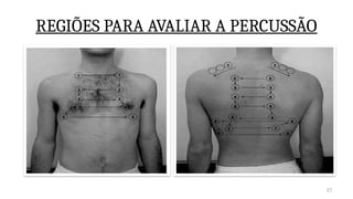 27
REGIÕES PARA AVALIAR A PERCUSSÃO
 