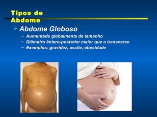 Absome Aula sobre Semiologia do Aparelho Digestivo | PPT