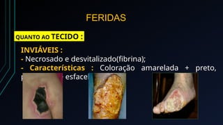 feridas e curativos-slide aula enfermagem | PPTX